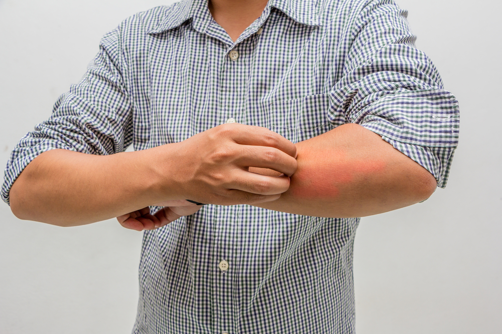 Ліки та методи лікування алергії на шкірі