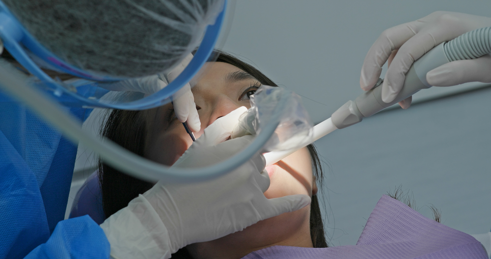 De ce să faci de rutină detartrajul dentar? Cunoașteți procedura și beneficiile