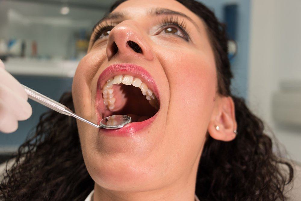 5 עובדות על שיני בינה שאתה צריך לדעת