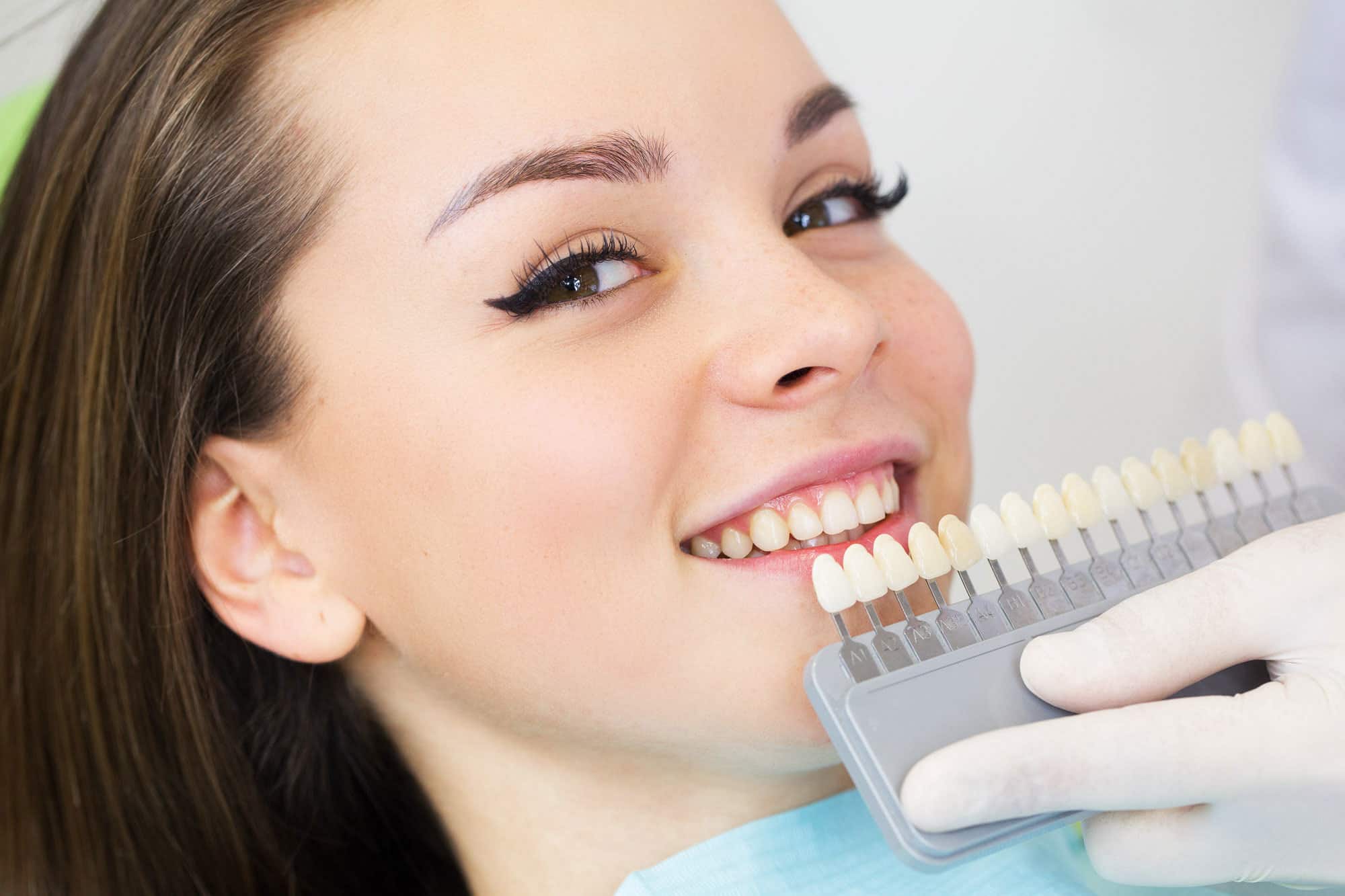 כל מה שאתה צריך לדעת על ציפוי שיניים
