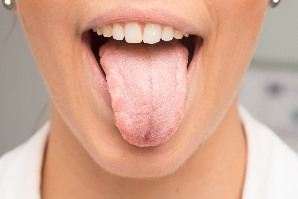 하얀 혀? 이 9가지 원인과 극복 방법!