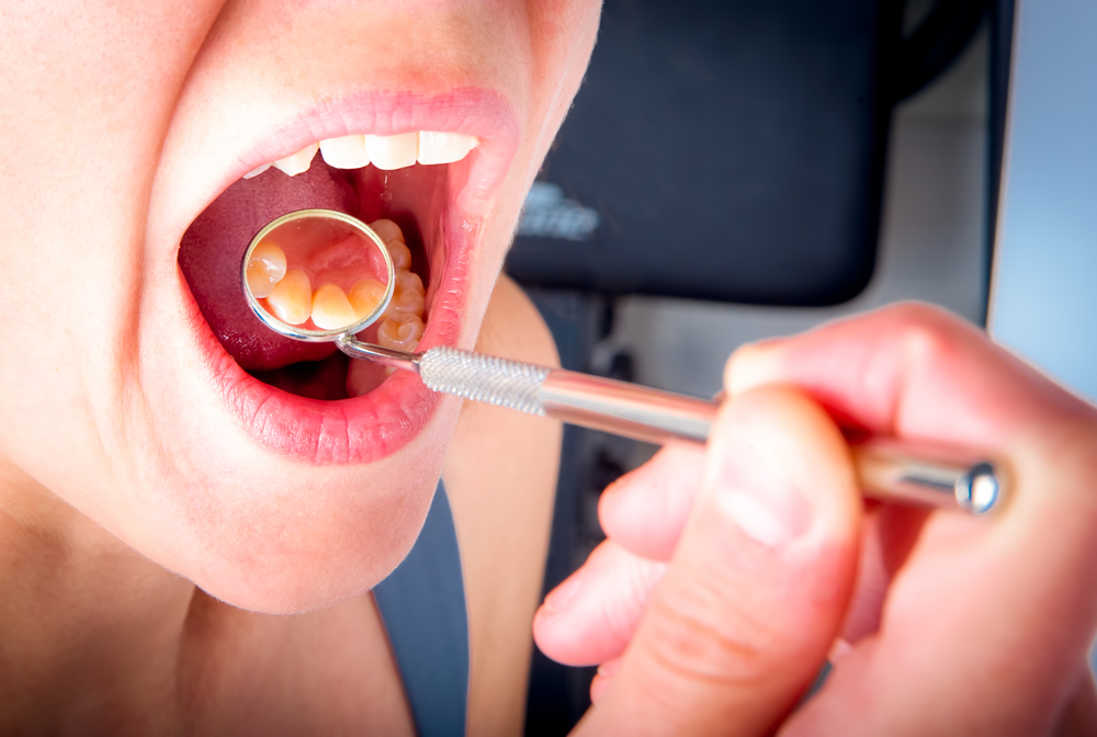 10 cauze ale durerii gurii și cum să o tratezi în siguranță