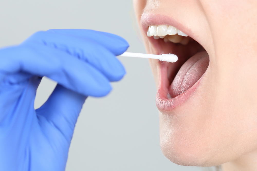7 Krankheiten, die die Speicheldrüsen im Mund angreifen