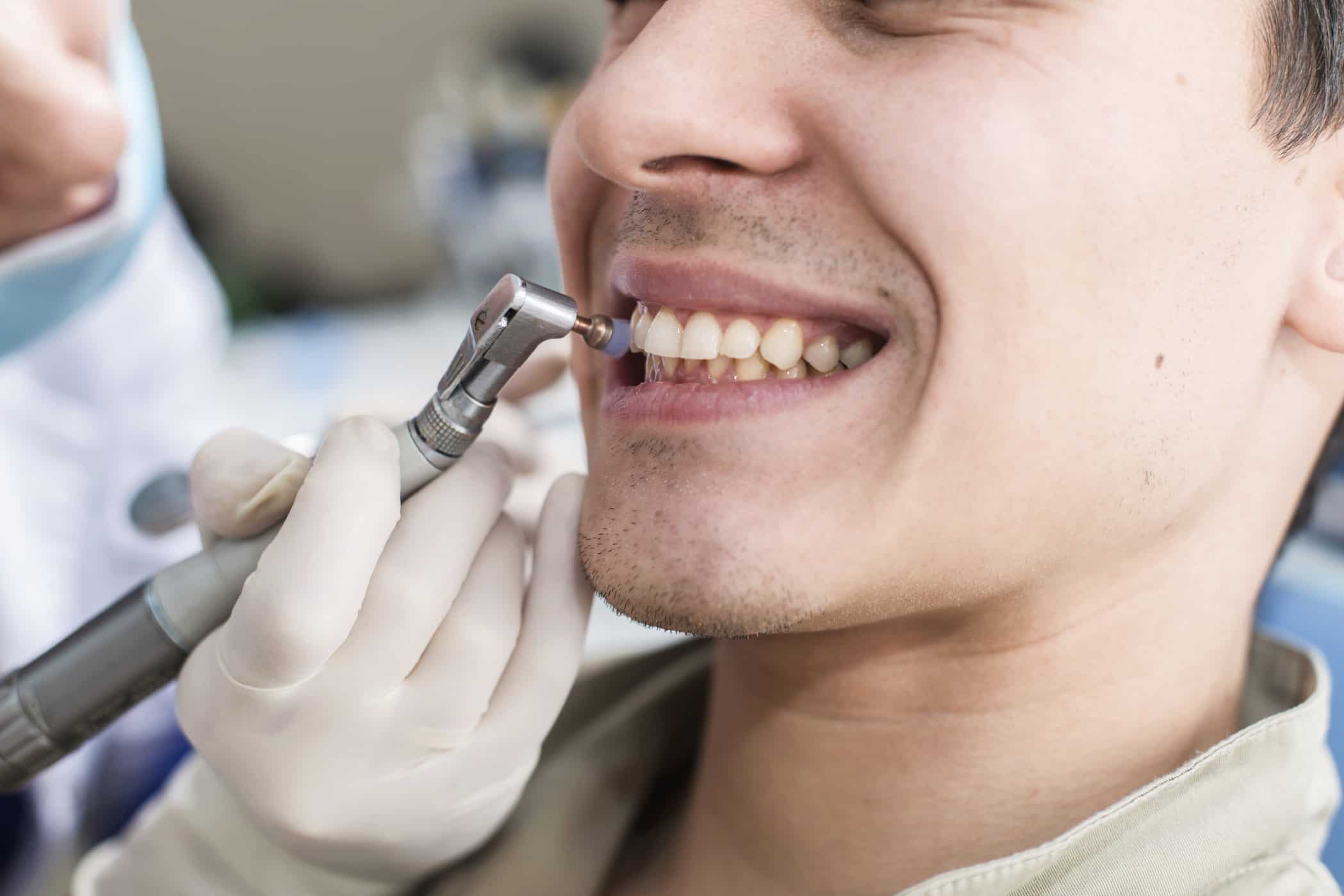 의사에게 시도할 수 있는 치아를 교정하는 7가지 방법