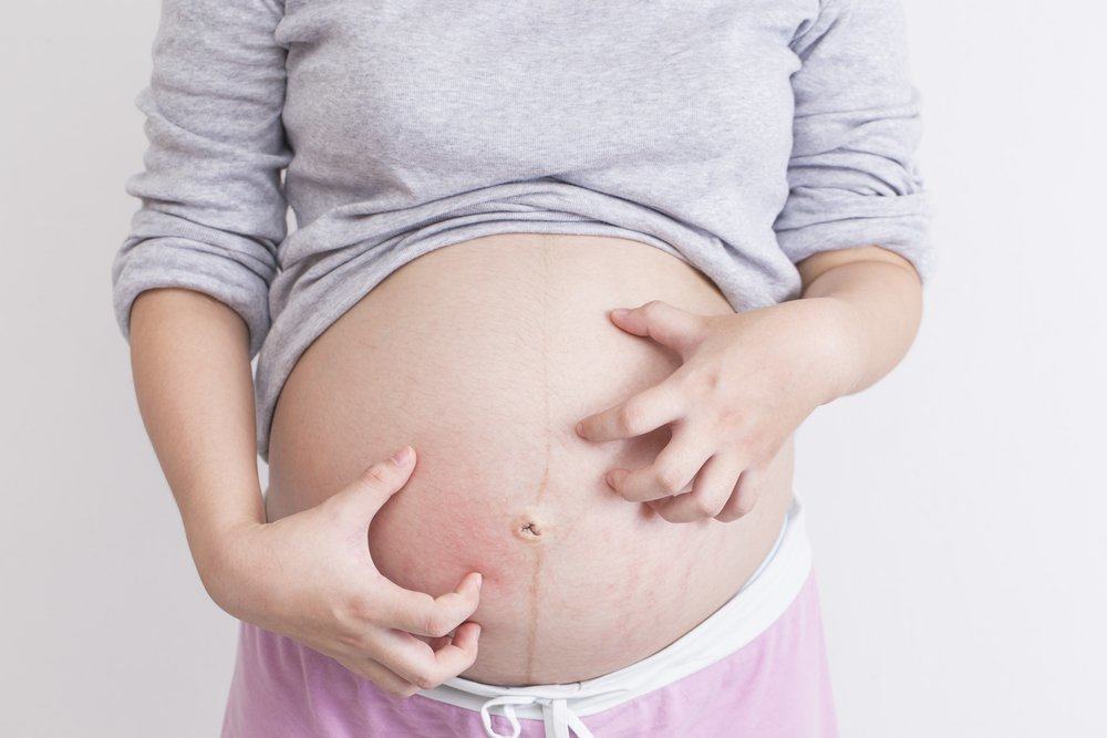 임신 중 배가 가렵다? 이것이 원인과 극복 방법