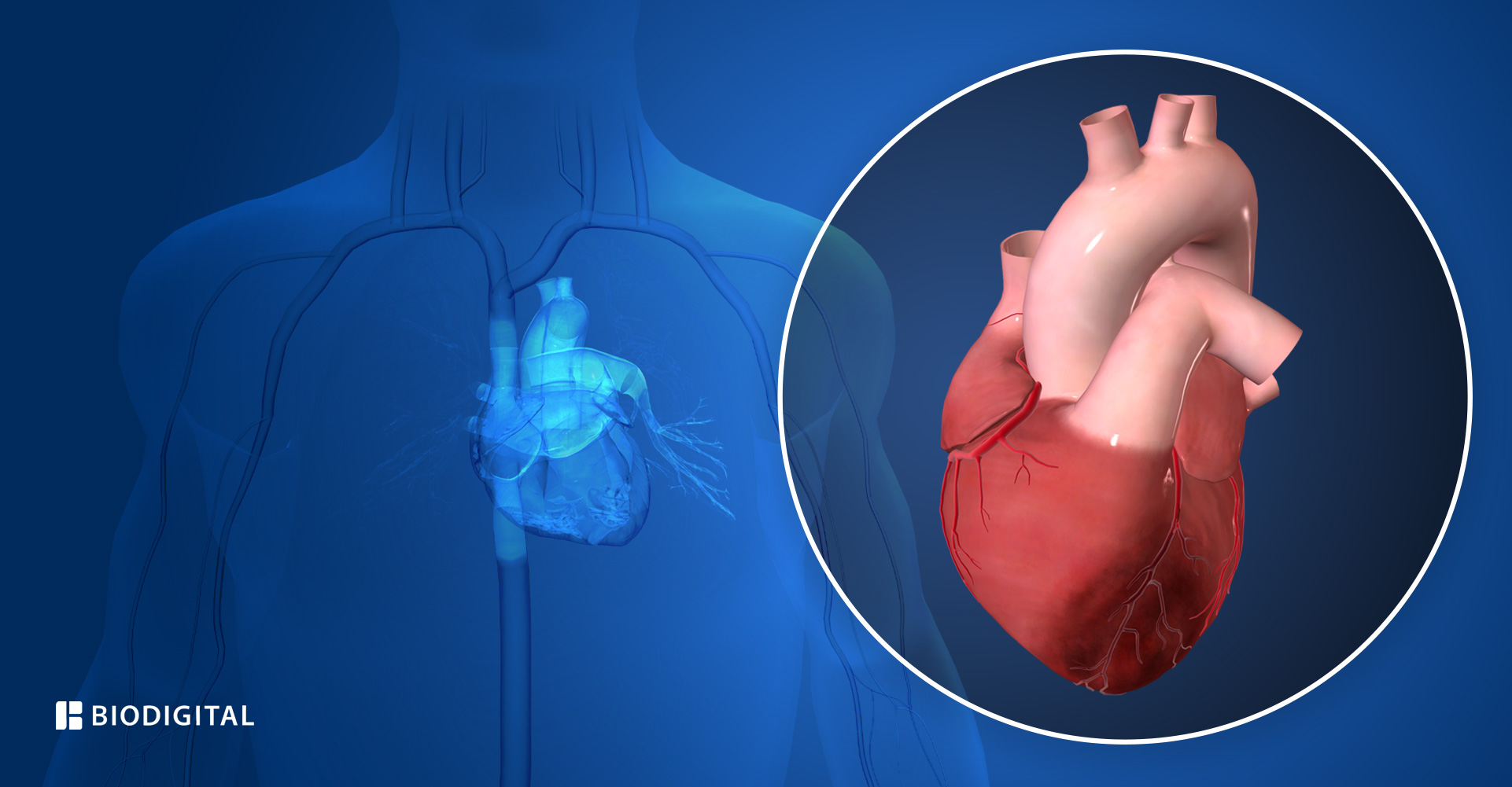 Verschillende oorzaken van hartaanvallen die belangrijk zijn om te weten