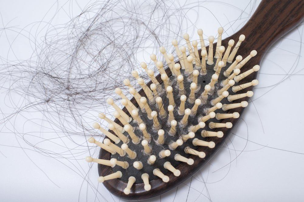 Это различные причины выпадения волос, которых вы не ожидаете