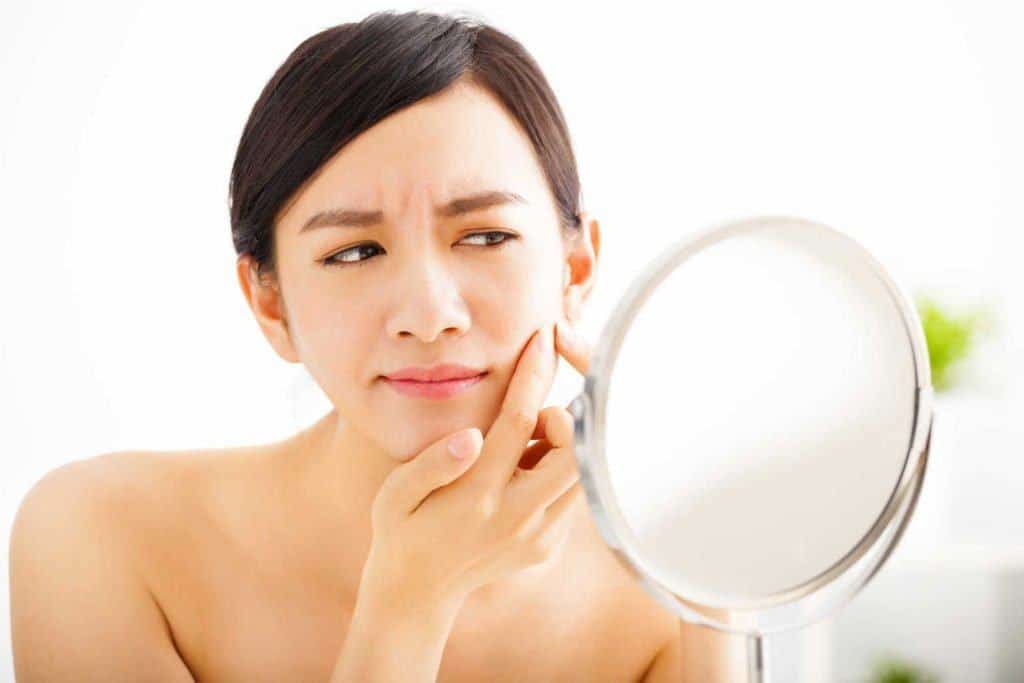 Hoe de acnehuid op de juiste manier te verzorgen?