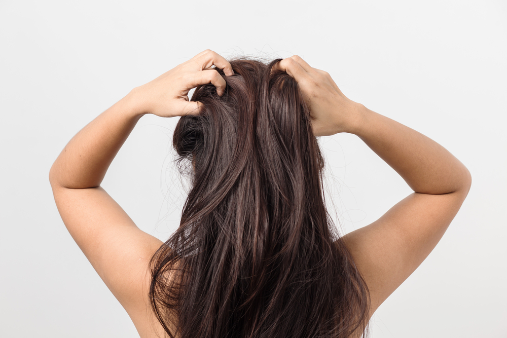 7 naturliga ingredienser som är effektiva mot torr hårbotten