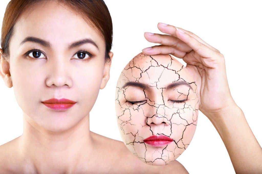 5 natuurlijke remedies om een ​​droge huid te behandelen