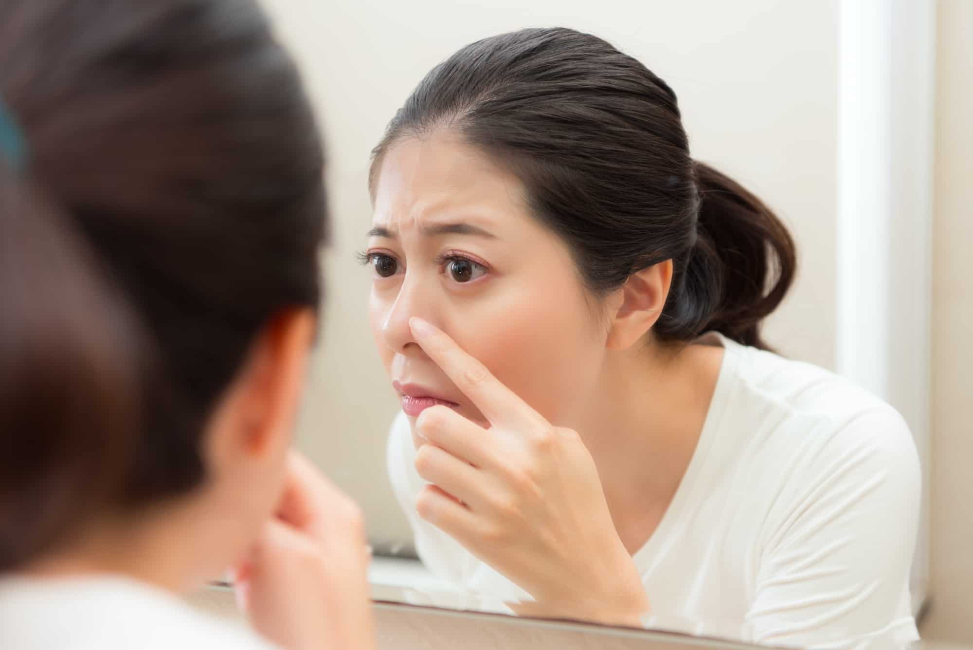 סיבות ודרכים קלות להתגבר על פצעונים מעצבנים באף