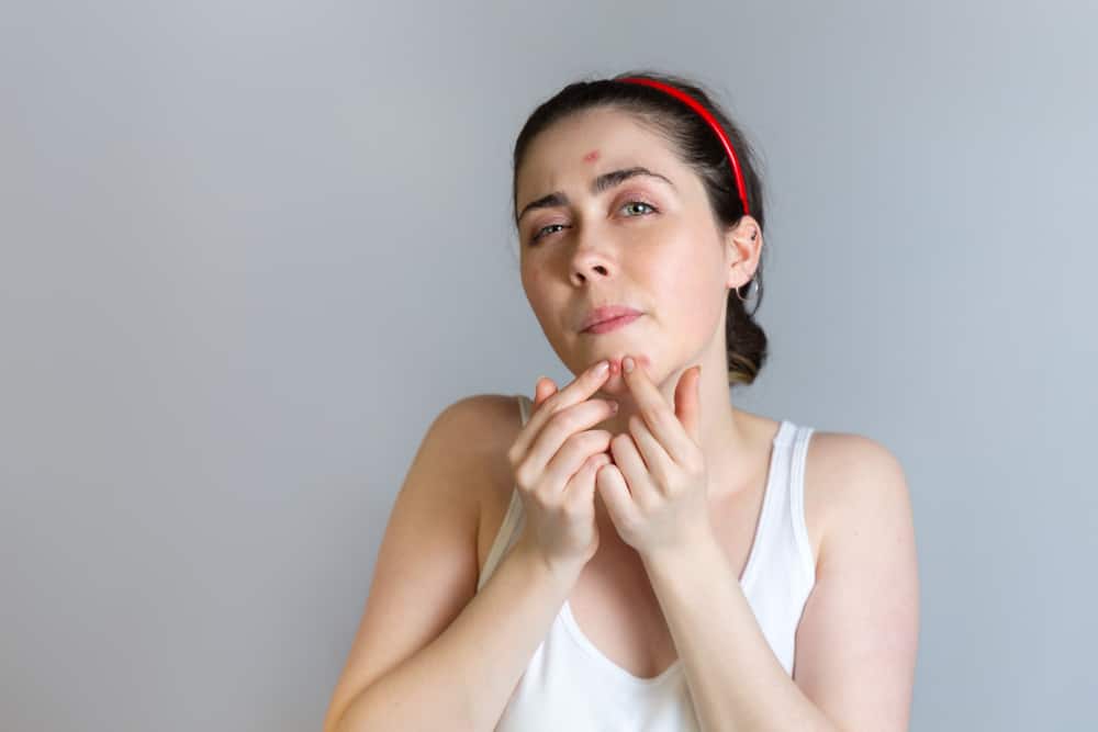 Reconocer las causas del acné en el mentón y cómo superarlo