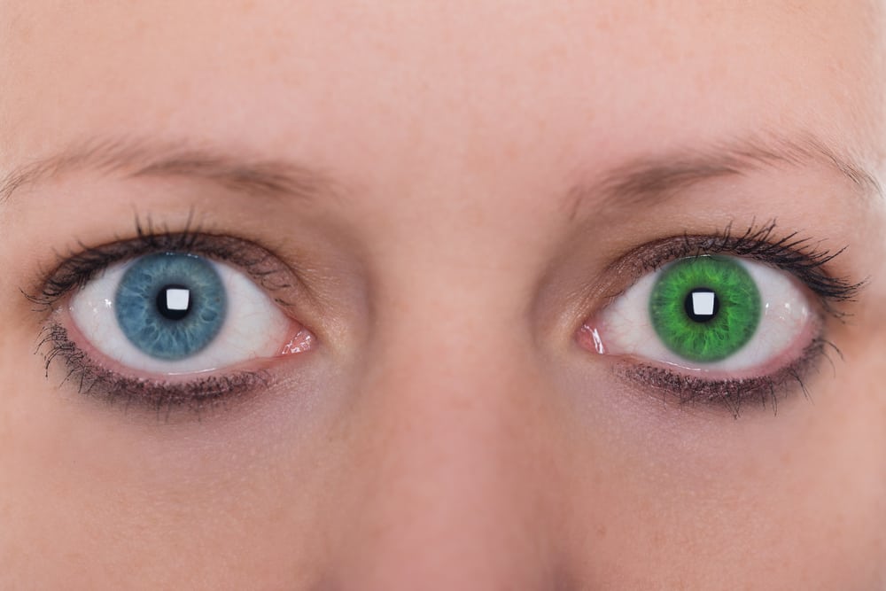 Heterochromie, als je ogen verschillende kleuren hebben