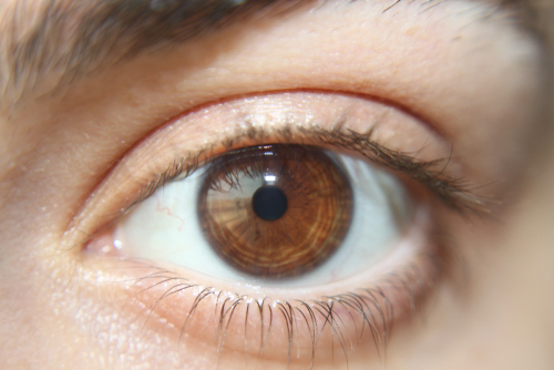4 anomalii care se pot întâmpla cu pupilele ochilor