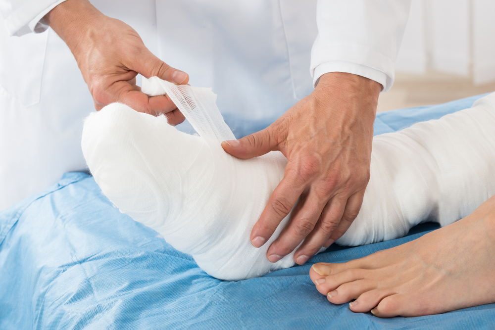 Gipsuri pentru fracturi: cerințe pentru o procedură și un tratament adecvat