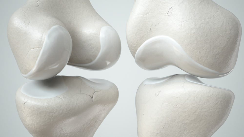Cunoașterea cartilajului, inclusiv tipurile, funcțiile și tulburările care pot apărea