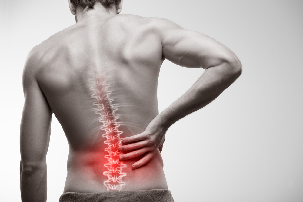 Aflați diferența dintre durerea obișnuită de spate și durerea de spate cauzată de nervii ciupit