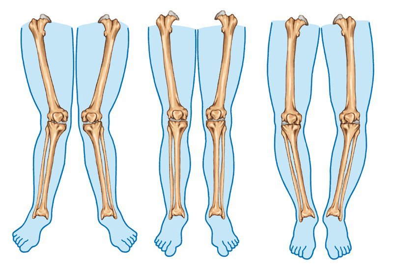 6 gyakorlat az X lábak formájának javítására
