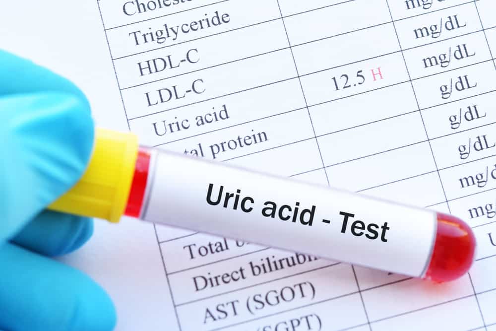 Cât de mult nivelurile de acid uric sunt clasificate ca normale?