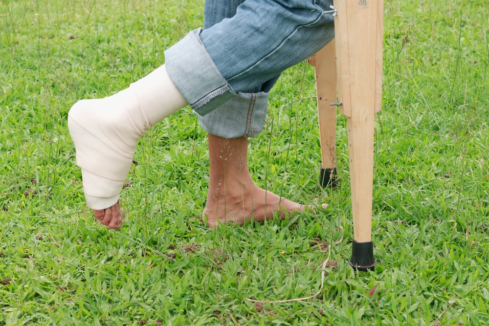 Lucruri importante de știut despre fracturile picioarelor și membrelor