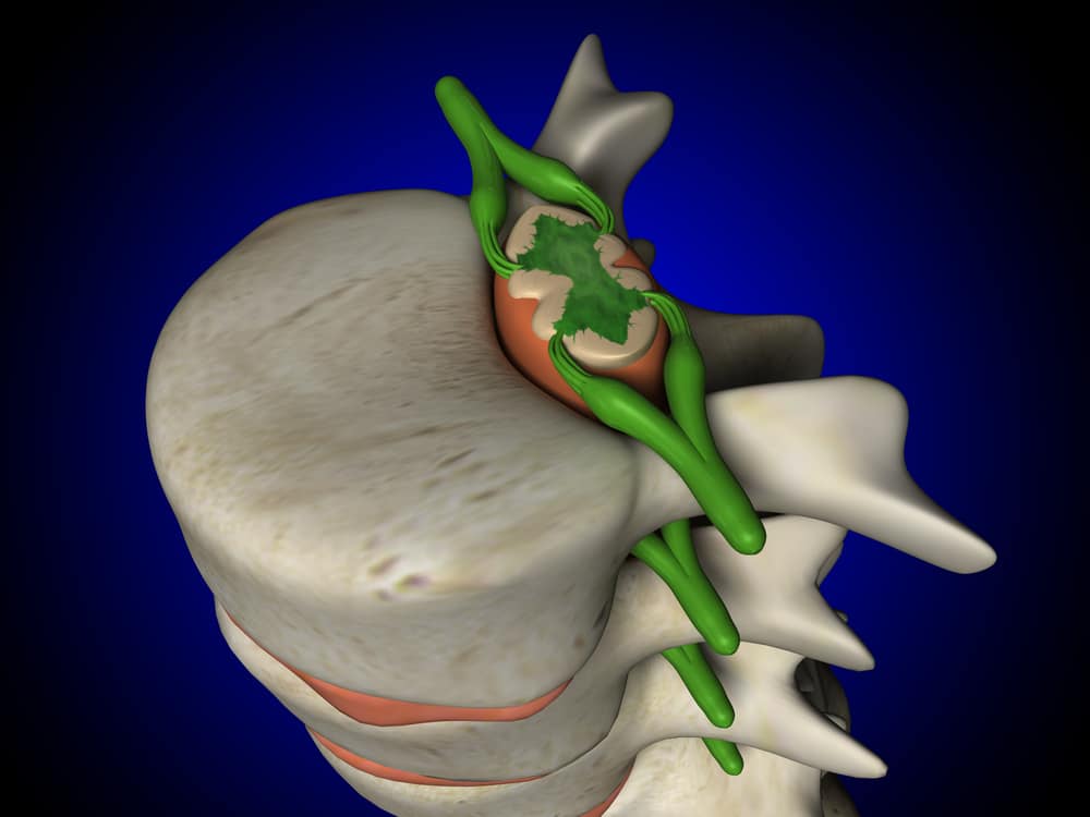 Cunoașteți anatomia, funcția și bolile măduvei spinării