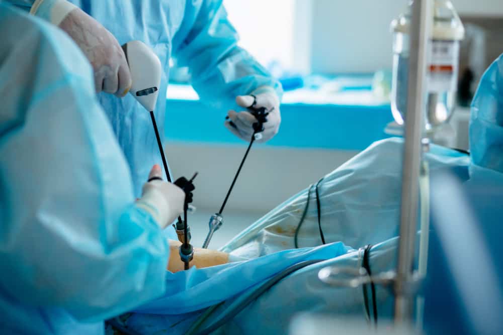 Cholecystectomieprocedure, operatie om galstenen te behandelen