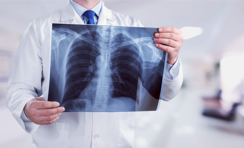 Ismerkedés a pleuropneumonia, a tüdő és a mellhártya gyulladásával