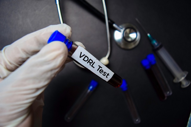 Syfilisdetectie met VDRL-test: hoe het werkt, resultaten en risico's