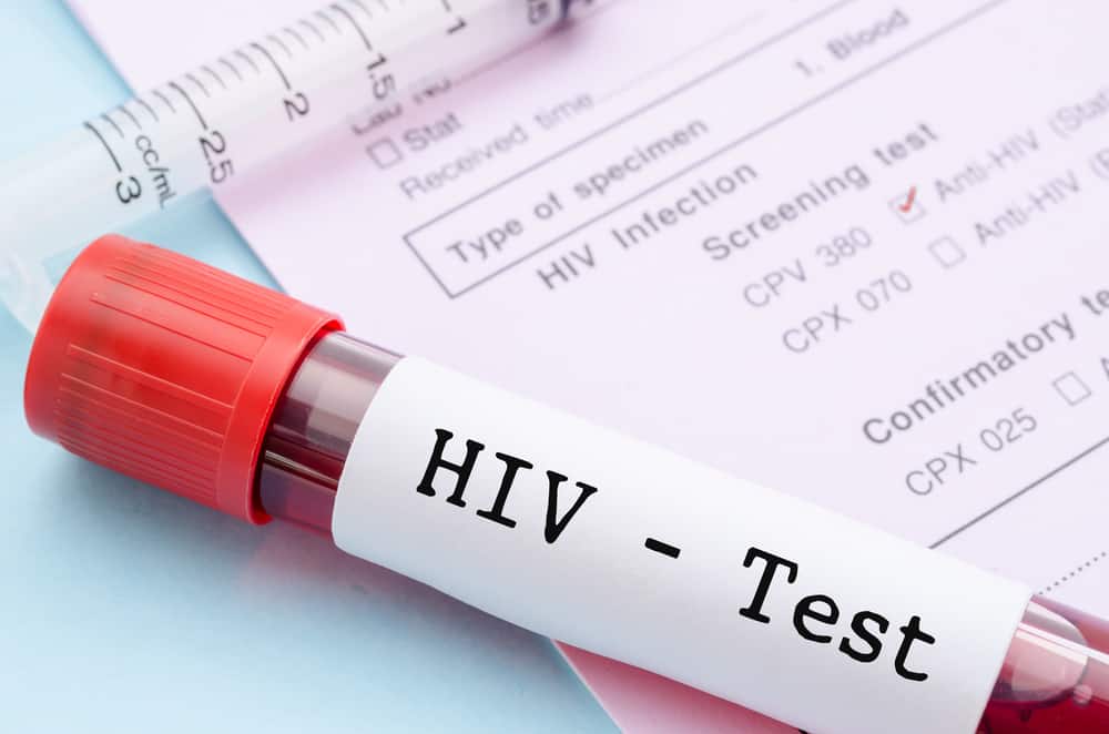 הכרת מצב HIV מתוצאות בדיקות שליליות, תגובתיות וחיוביות