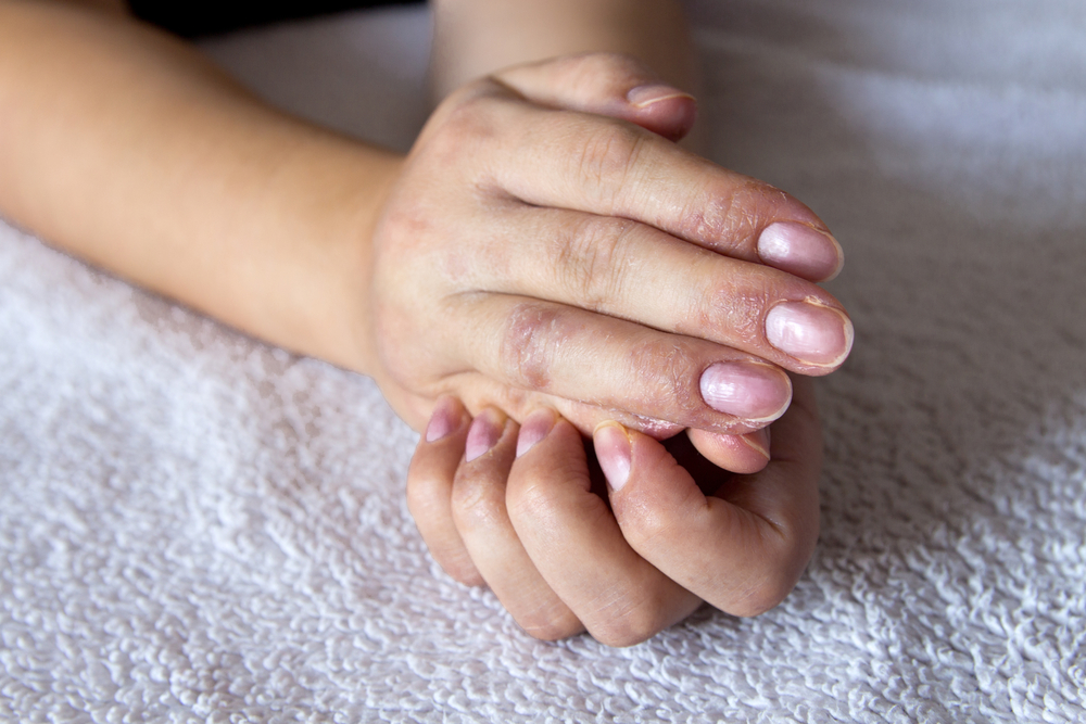 5 בעיות בריאות הגורמות לגירוד באצבעות
