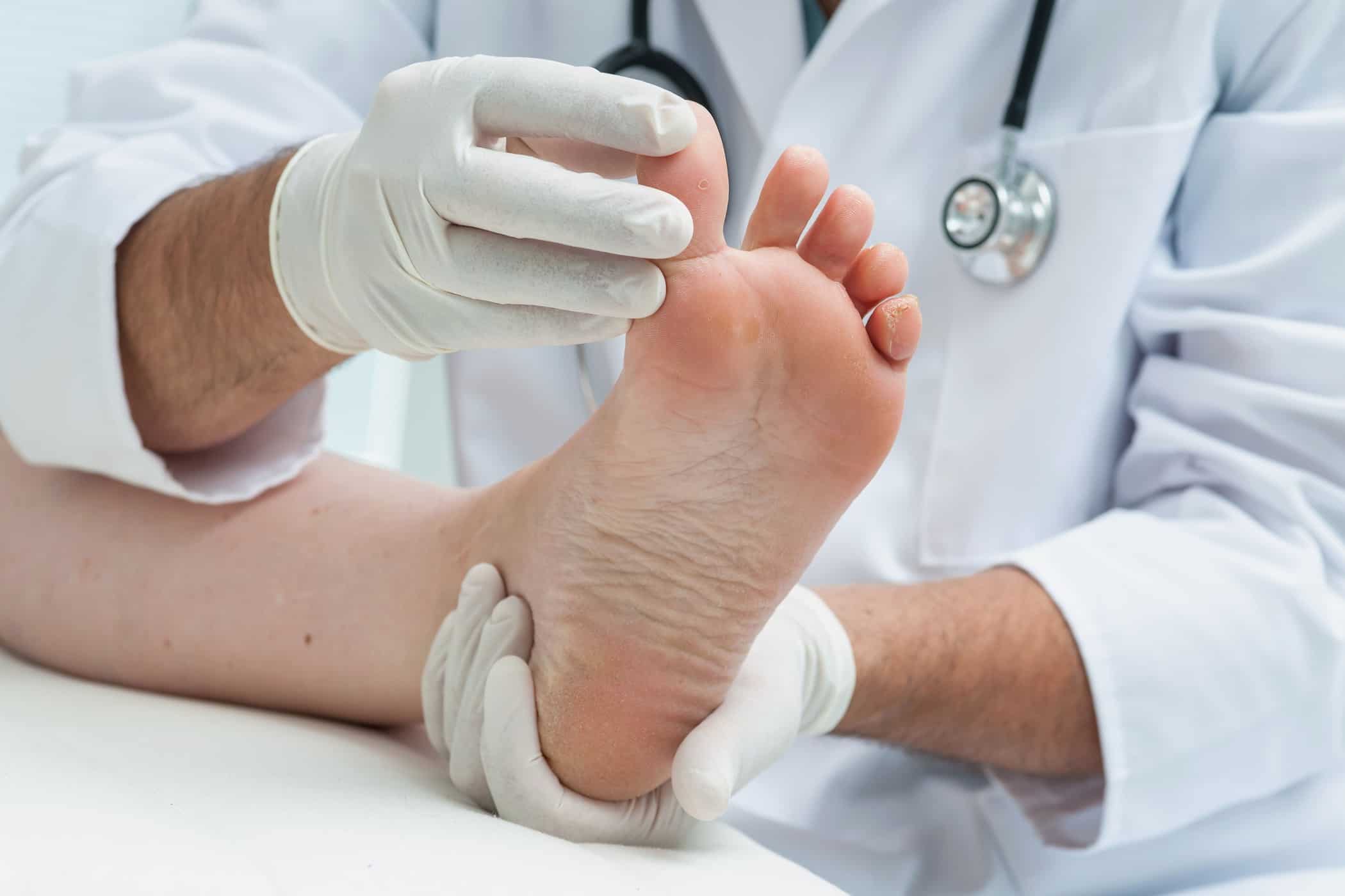 발 상태에서 질병을 감지할 수 있습니까?
