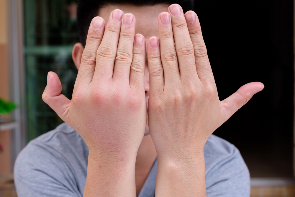 5 סיבות מדוע הידיים שלך נפוחות פתאום בבוקר