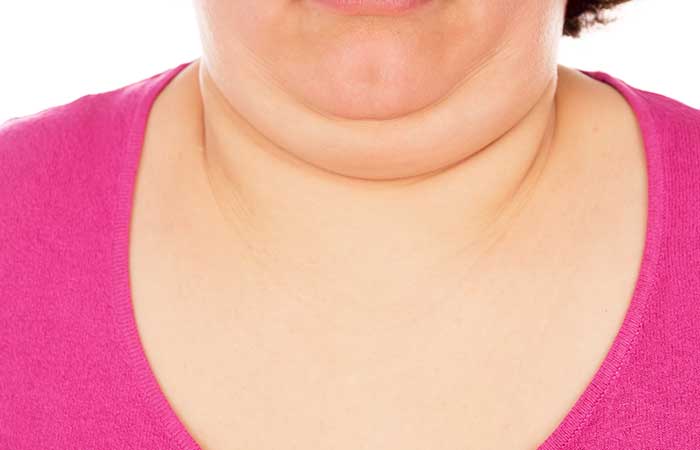목 지방(이중턱)을 제거하는 다양한 효과적이고 효과적인 방법
