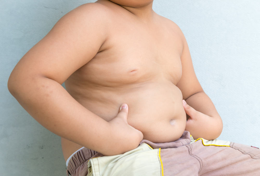 Ожирение у детей: симптомы, осложнения и способы его преодоления