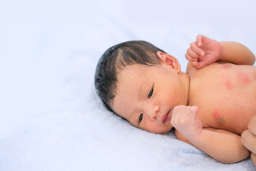 Protuberancias rojas en los bebés: causas y cómo superarlas