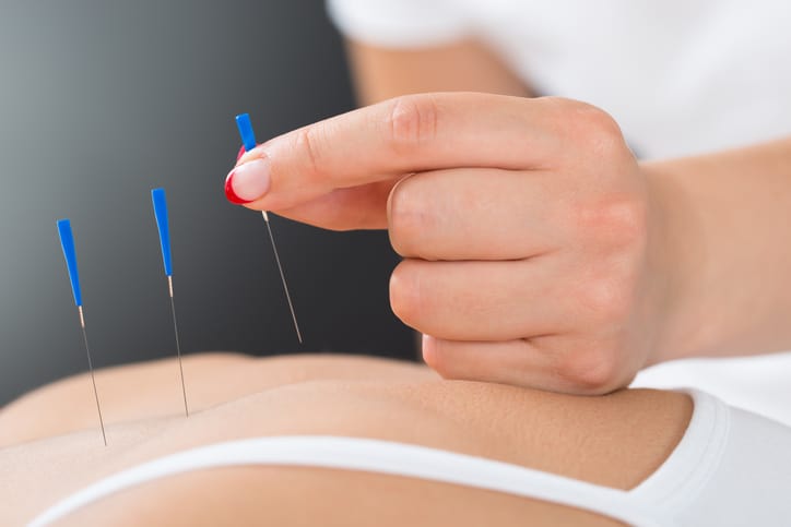 Diverse beneficii și riscuri ale acupuncturii