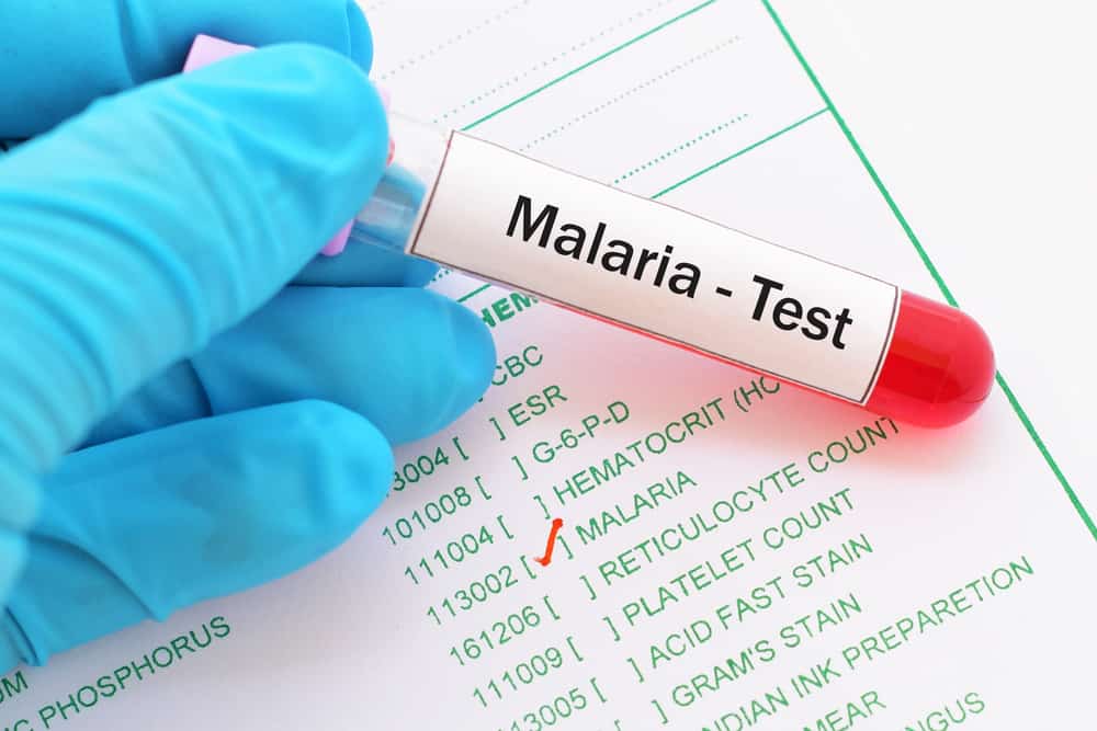 무시해서는 안되는 말라리아의 징후와 증상