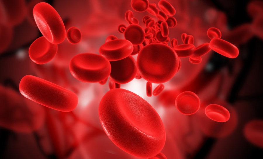 혈액 검사 후 헤마토크릿 수치가 낮다는 것은 무엇을 의미합니까?