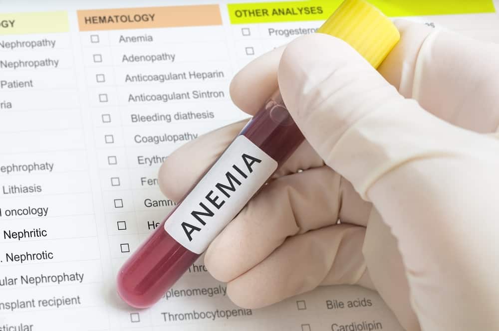 Diverse opțiuni de tratament pentru a trata anemie