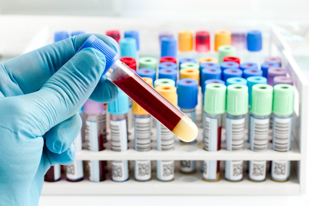 4 סוגים של מרכיבי דם אנושיים ותפקידיהם