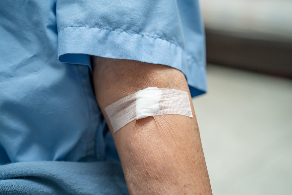 MCV 검토, 빈혈 유형을 결정하기 위한 적혈구 검사