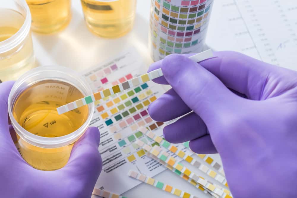 Egenskaper för normal urin beroende på färg, lukt och mängd